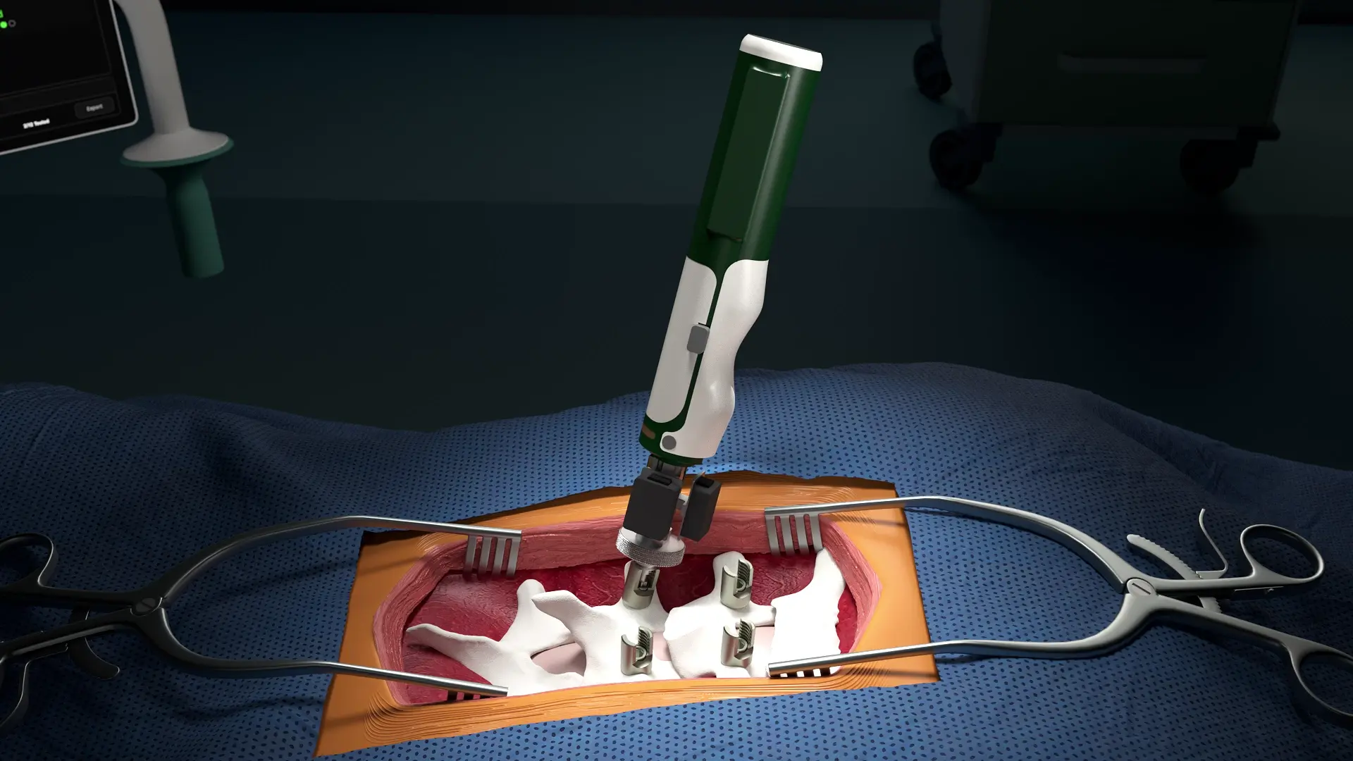 Metric Surgical instrument in a spinal surgery concept visualization